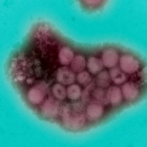 h1n1 © Jonas Kisielius e Marli Ueda/IAL